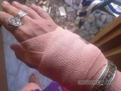 эластичный бинт на руку и в путь